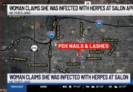 Tiệm nail bị khởi kiện vì làm khách hàng nhiễm virus herpes 2 lần trong 2 năm